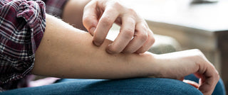 Everything You Wanted to Know About Mosquito Bites